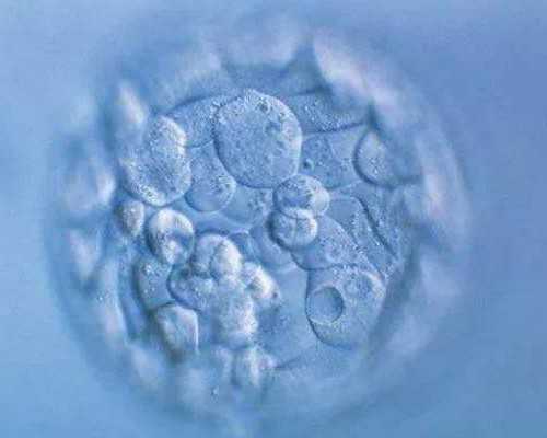 重庆供卵一般需要多少钱 重庆试管助孕机构排名重庆市妇幼保健院 ‘唐筛数据